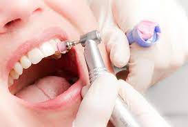 Limpieza dental clínica